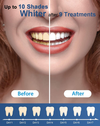 MySmile Teeth Whitening Kit with LED Light, Non-Sensitive Teeth Whitener with 4 Whitening Gel Pens, 10 Min Fast-Result Home Tooth Whitening Dental Care Help Remove Teeth Stain